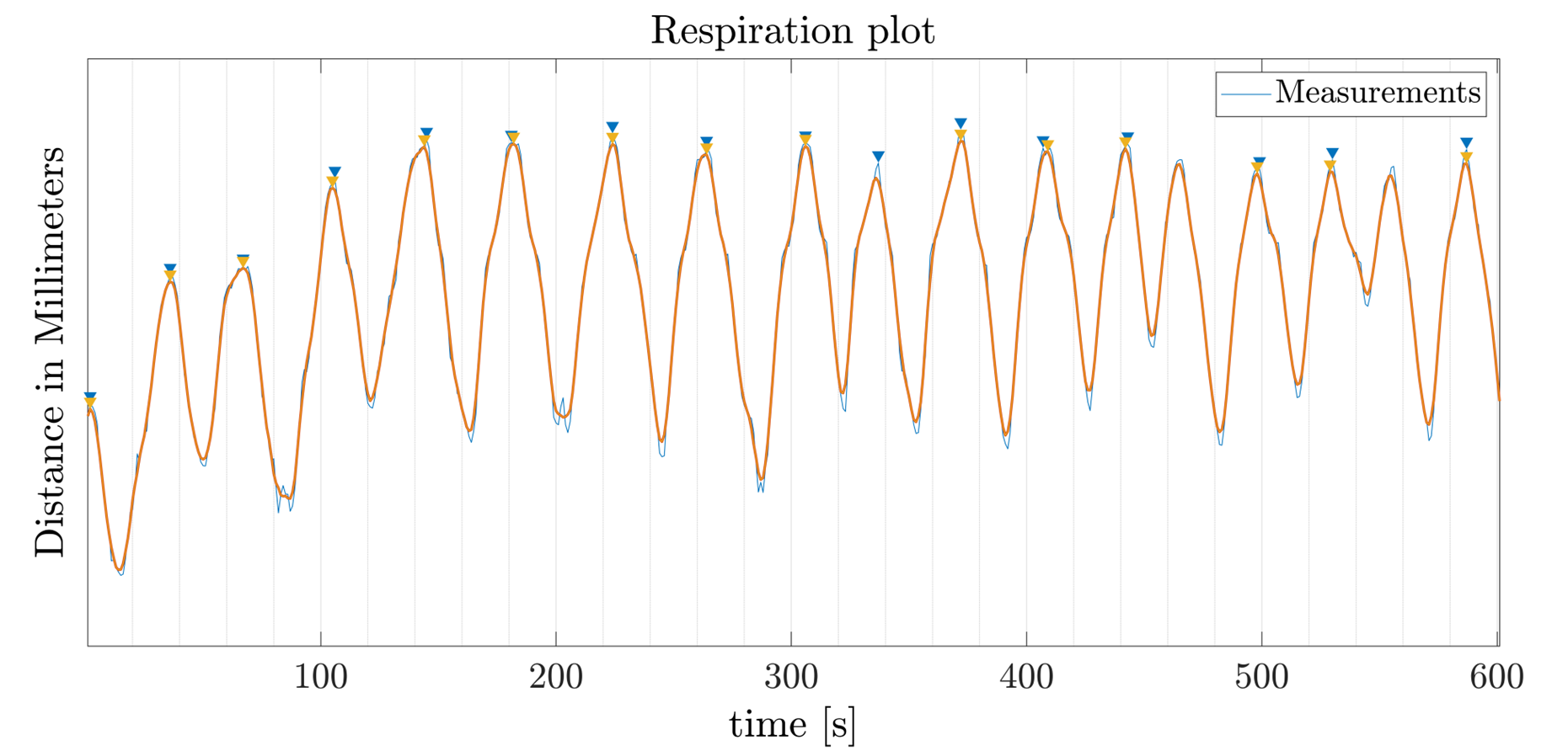 Noise filtering and respiration rate peaks detection (Plot: CERN).