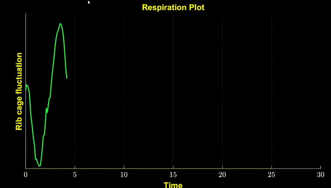 Respiration plot: rib cage fluctuation over the time